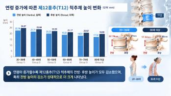 국제성모병원 김영욱 교수팀, 여성 409명 척추 MRI 분석